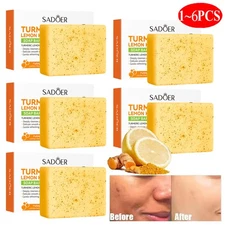 Lemon Turmeric Soap Bar, Organic Tumeric Soap for Face and Body, Deep Clean 100g