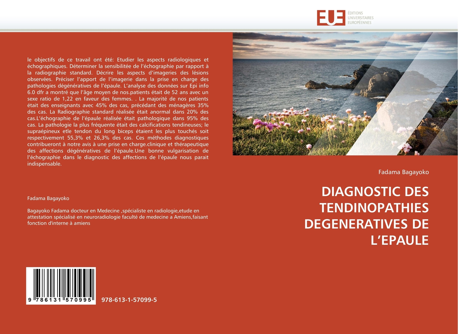 Diagnostic Des Tendinopathies Degeneratives De L¿epaule | Fadama