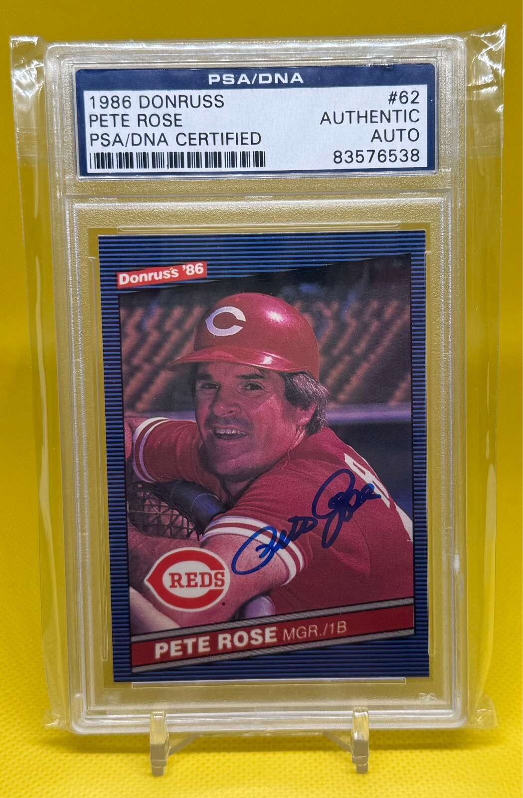 ⚾️Pete Rose REDS Autograph✍️ 1986 Donruss Card # 62 PSA/DNA Authentic;