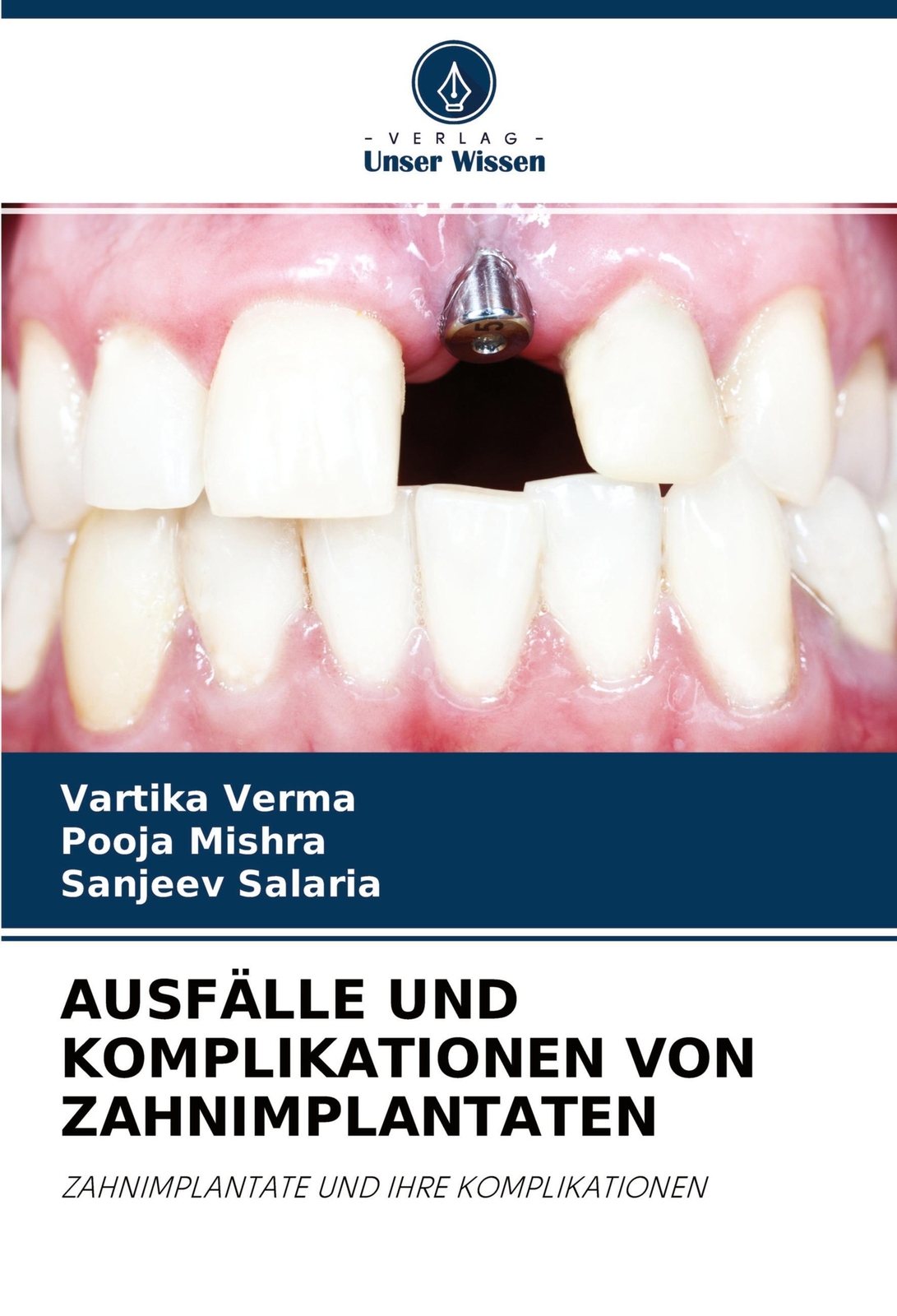Thumbnail - Ausfälle Und Komplikationen Von Zahnimplantaten Vartika Verma (u. A.)