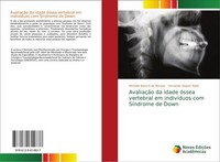 AvaliaçãO Da Idade óSsea Vertebral Em IndivíDuos Com SíNdrome De Down Fernando V