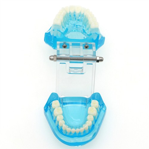 Multiple Types Dental Teeth Model Ortho Implant Practice Teaching Demo Model - Picture 225 of 276