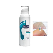 Footlogix DD Cream Mousse 125ml/4.23oz