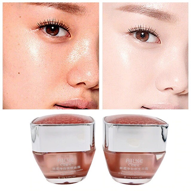 best cream for freckles