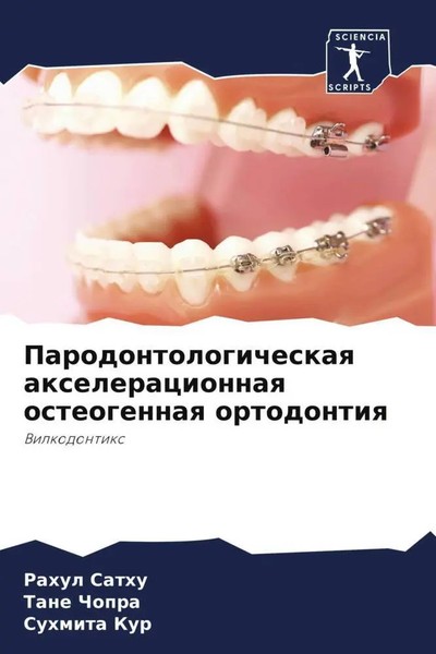 Rahul Sathu (U. A.) | Parodontologicheskaq Axeleracionnaq Osteogennaq Ortodontiq-image