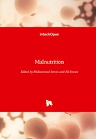 Muhammad Imran (U. A.) | Malnutrition | Buch | Englisch (2020) | Gebunden