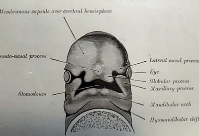 ''Membranous Capsule Cerebral Hemisphere'' #AP0318 35mm Vintage Photo Slide PS03.
