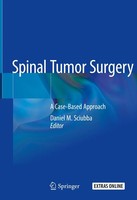 Daniel M. Sciubba | Spinal Tumor Surgery | Buch | Englisch (2019) | Xviii