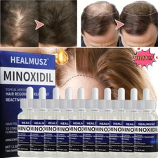 HEALMUSZ Minoxidil 5% Extra Strength Men 10 Month Supply Hair Regrowth Solution