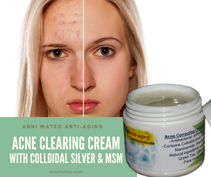 msm cream for acne