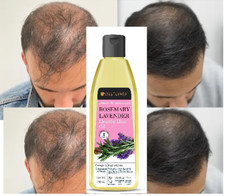 Soulflower Rosemary Lavender Hair Oil For Healthy Hair, Scalp Nourishment 120Ml