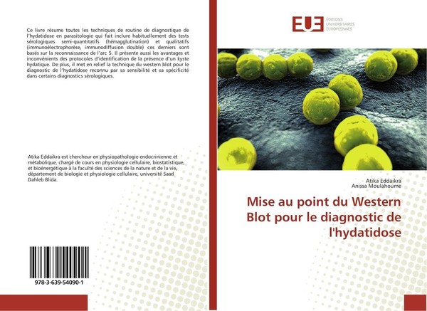 Mise Au Point Du Western Blot Pour Le Diagnostic De L'hydatidose Atika Eddaikra-image