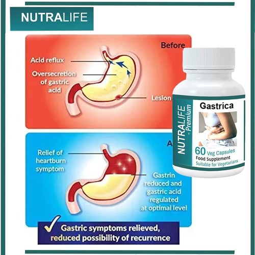 Geschwüre Magen natürlich 60 Kapseln Magengeschwüre Säurereflux Magenschmerzen 250mg - Bild 4 von 7