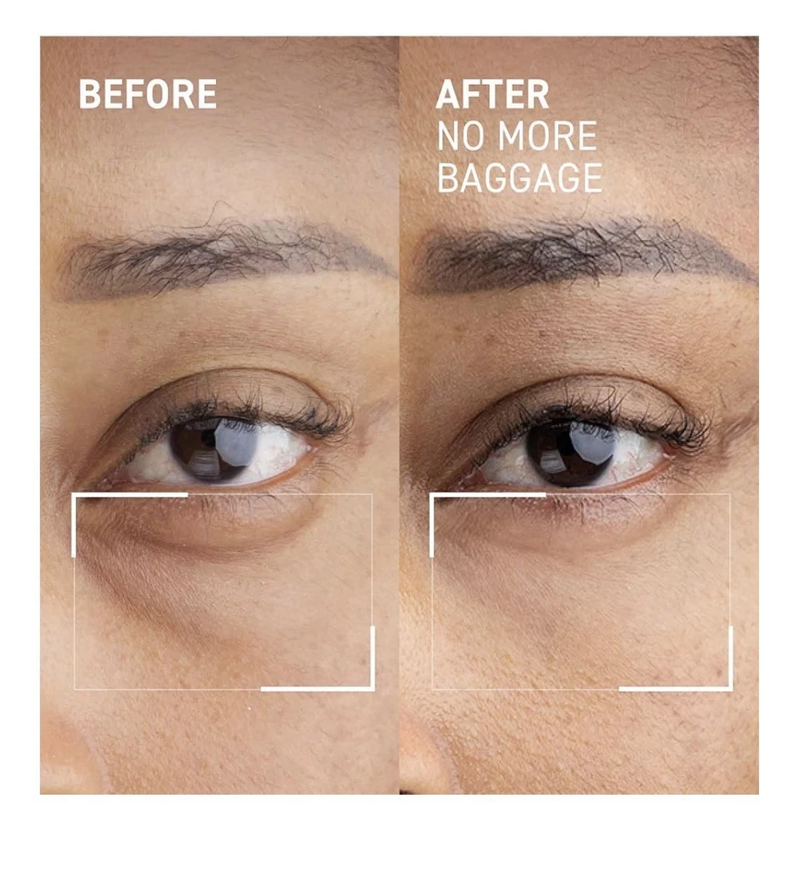 Dr. Brandt Needles No More, No More Baggage - Minimizes Under-Eye Bags - Image 2 of 4