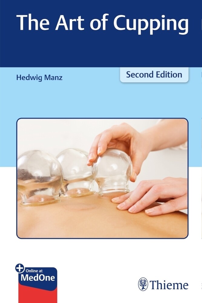 Thumbnail - The Art Of Cupping | Plus Online At Medone | Hedwig Manz | Englisch |