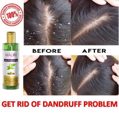 New Natural & Ayurveda Shampoo For Dandruff And Hair Fall Get 100% Result FS