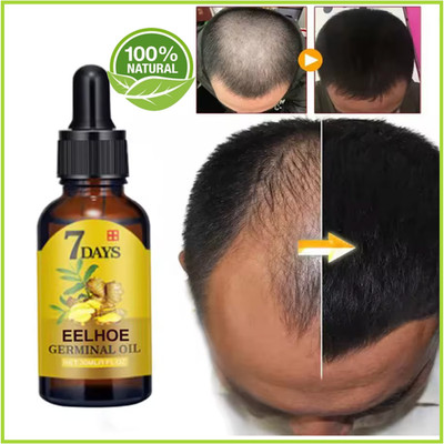 #1 Ginger Hair Growth Oil Anti Loss Strengthening Scalp Nourishing Hair Roots *