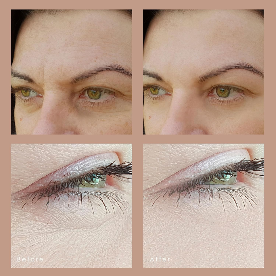 Lumaglow Red LED Light Therapy by Skin Rejuvenation and AntiAging