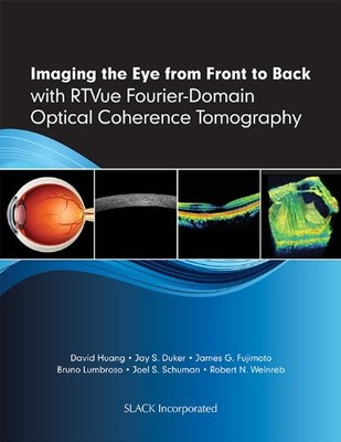 IMAGING THE EYE FROM FRONT TO BACK WITH RTVUE By Huang David Md & Jay S. Duker