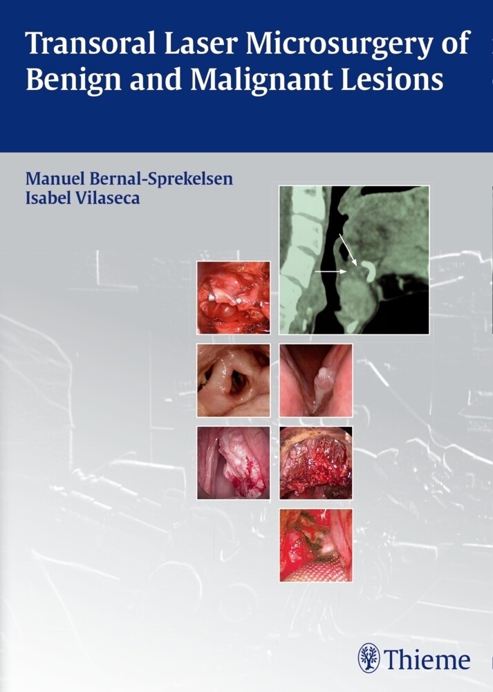 Thumbnail - Transoral Laser Microsurgery Of Benign And Malignant Lesions Buch 324