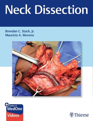 Neck Dissection | Brendan C Stack Jr (u. a.) | Englisch | Buch | 317 S. | 2018