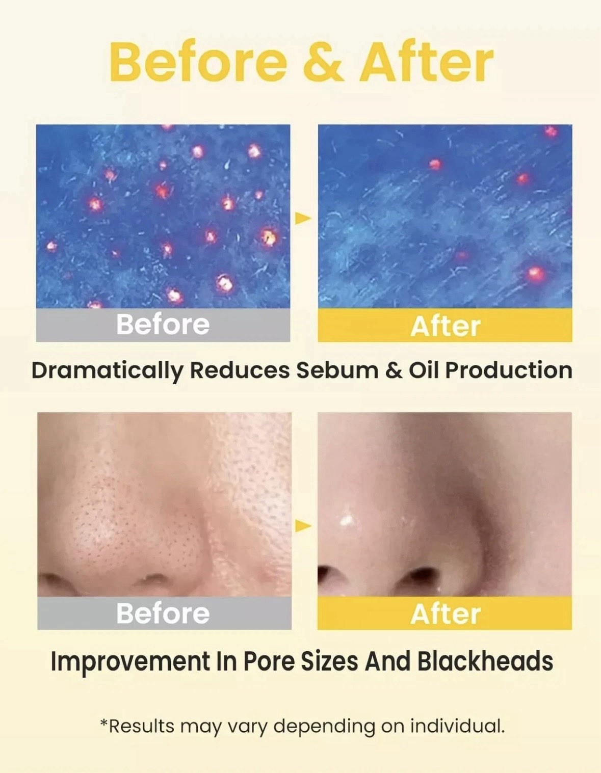 Elvira Pore Control Cleansing Oil Makeup Remover for Sensitive Oil Cleanser f...