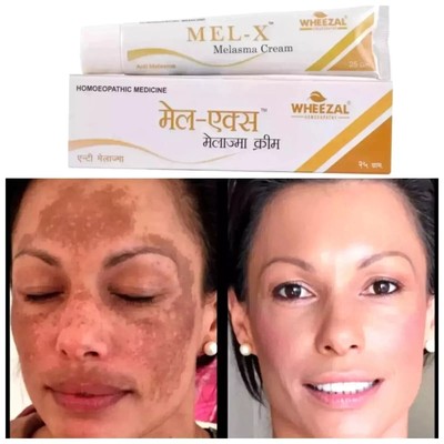 Crème Wheezal Mel-X 25g Contre Mélasma Et Hyperpigmentation - Expire Avril 2027
