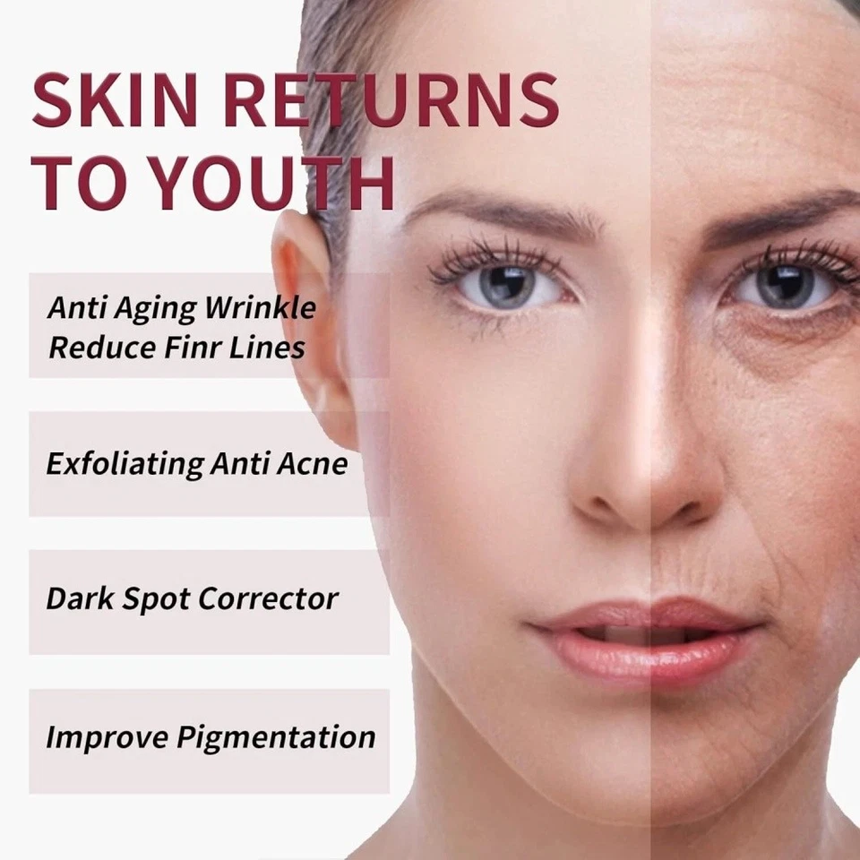 THE ORDINARY AHA 30% + BHA 2% Peeling Solution 30ml – Clears Blemishes & Pores - image 3 of 4