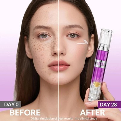Dark Spot Remover for Face and Body Musely Dark Spot Remover for Melasma Sun ...