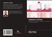 Mohit Sharma (U. A.) | Implants InclinéS | Taschenbuch | FranzöSisch (2021)