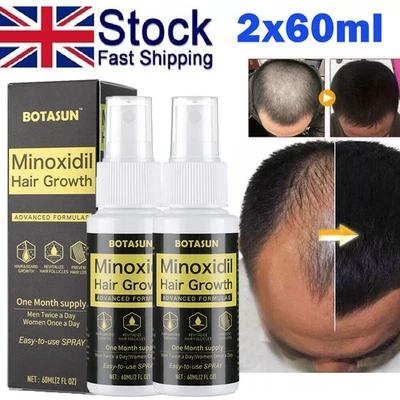 BOTASUN 2Pcs Minoxidil 5% Extra Strength Hair Growth Spray Fast Regrowth Scalp Treatment