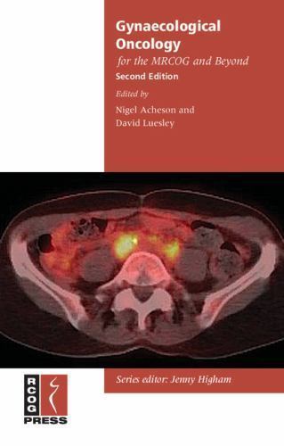 Gynaecological Oncology for MRCOG Beyond 2e Paperback 9781906985219 Cond=LN:NSD
