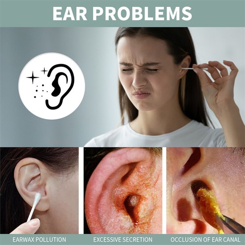 Hearing Restoration Spray, Earwax Cleaning Spray,Tinnitus Spray for Ear 30ml UK - Picture 9 of 15