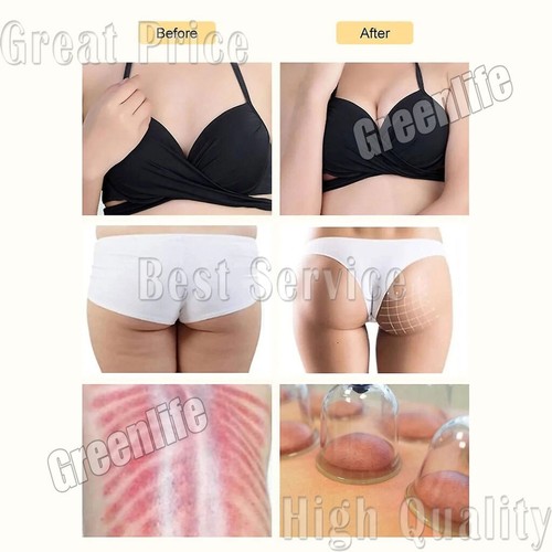 Breast & Buttock Enlargement Vacuum Therapy Machine Body Shaping Cupping Massage - Picture 15 of 15