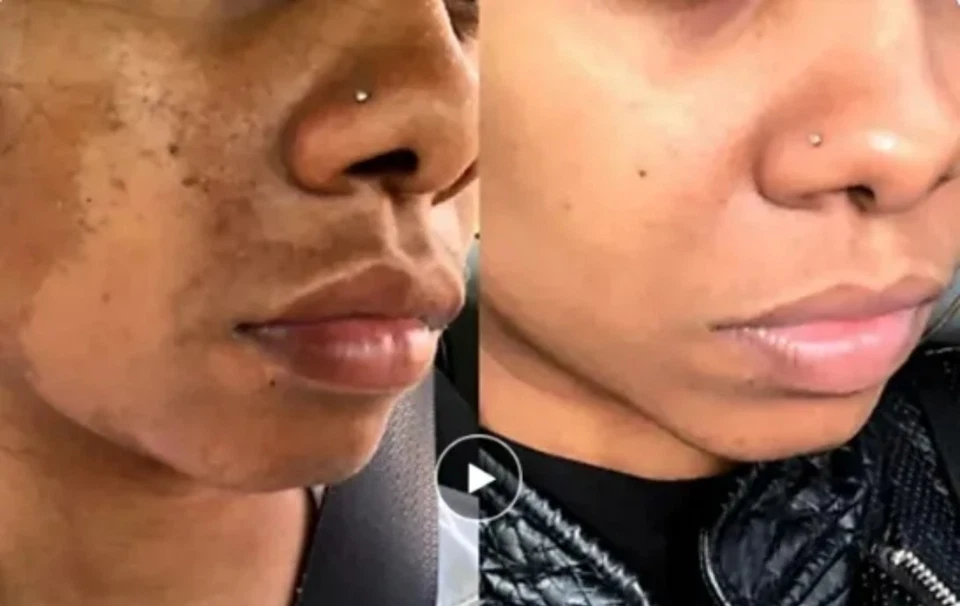 Vitamin C Exfoliating + Kojic Skin Whitening Body Wash, 4000ml [USA Stock 🇺🇸]  - Image 4 of 4