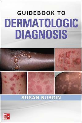 Guidebook to Dermatologic Diagnosis by Susan Burgin (Paperback, 2021)