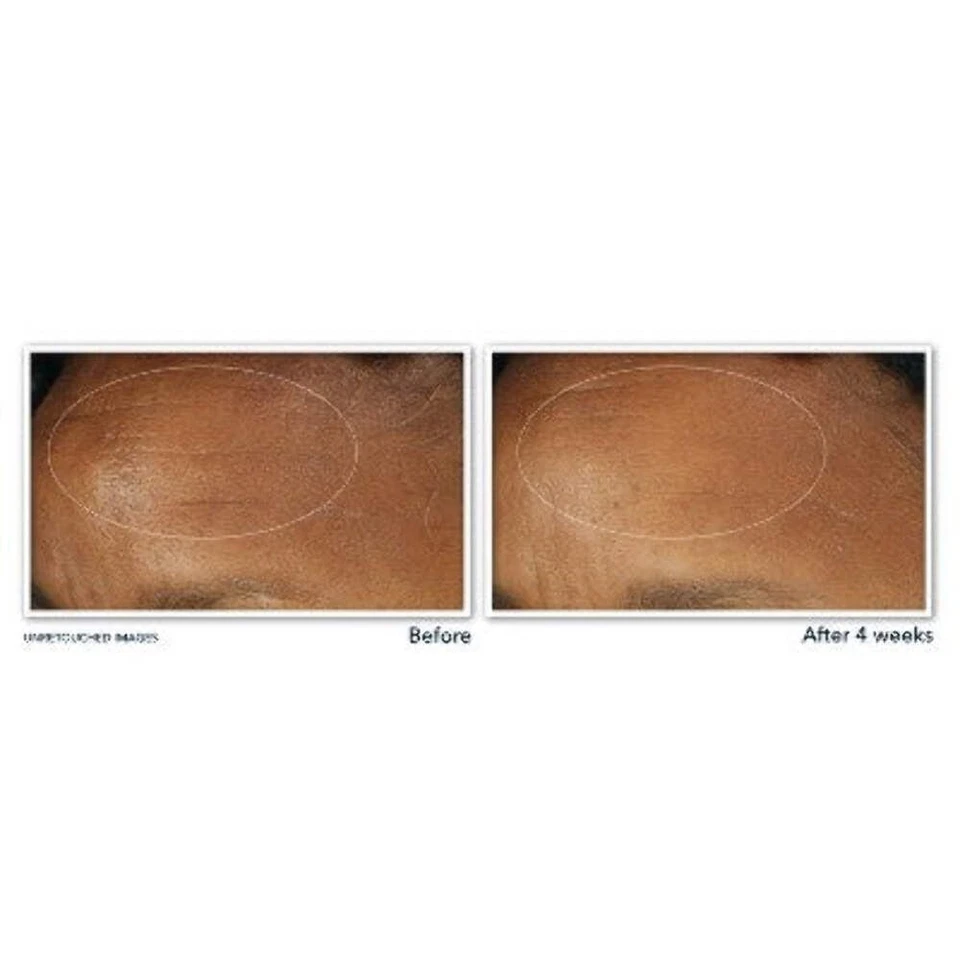 RoC 视黄醇 Correxion 深层抗皱保湿霜 SPF 30 1 液量盎司 - 全新 — 第 4/4 张图片