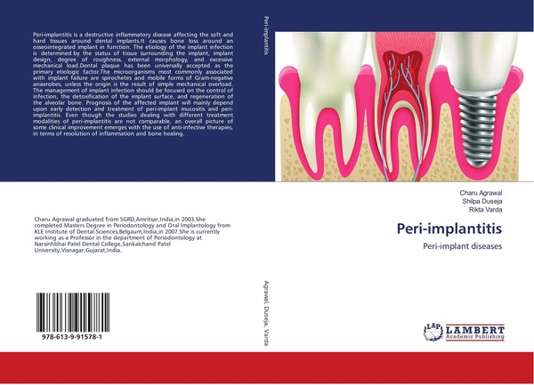 Charu Agrawal (U. A.) | Peri-Implantitis | Taschenbuch | Englisch (2018)-image