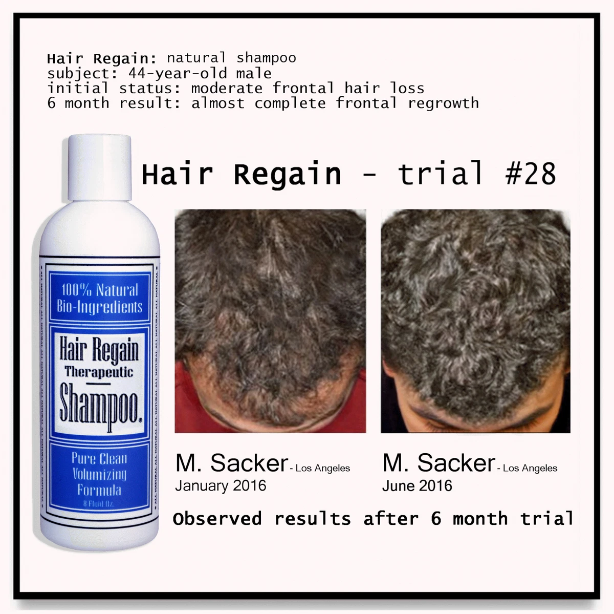 Regaine shampoo outlet