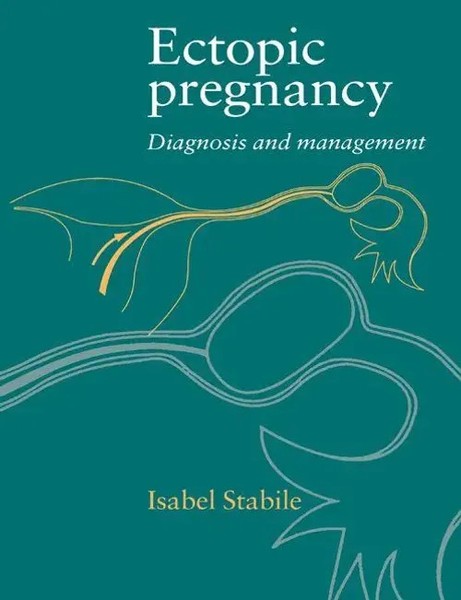Isabel Stabile | Ectopic Pregnancy | Taschenbuch | Englisch (2003)-image