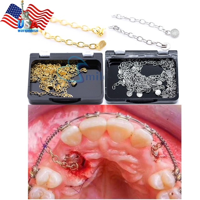 Lingual Button Chian Dental Braces Orthodontic Gold Sliver Round