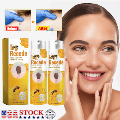 #ad #ad 2x Bee Venom Recovery Spray is Suitable for All Skin Types of Natural Bee Venom $9.59