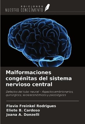 Malformaciones congénitas del sistema nervioso central Flavio Freinkel Rodrigues