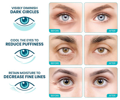 under Eye Patches for Dark Circles and Puffy Eyes (30 Pairs), Marine Collagen...