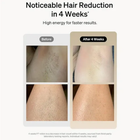 Professional Laser Epilator IPL Hair Removal Body Bikini Leg Depilatory Devic 90