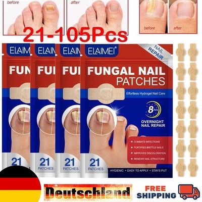 Nagelpilz Reparaturpflaster, Pilzbehand lung, Nagelreparatur, 21-105Stück