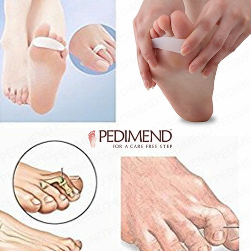 PEDIMEND™ Silicone Gel Single Loop Hammer Toe Straightener for Overlapping Toes - Picture 7 of 12