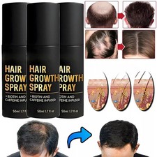 HaloGrow Hair Growth Spray 50ml Natural Hair ...