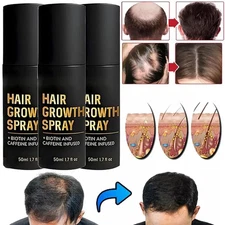 HaloGrow Hair Growth Spray 50ml Natural Hair Thickening Gentle Regrowth Mist