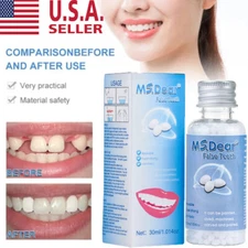 DIY Instant Fit Tooth Filler Thermal Beads Temporary Teeth Repair for Dental